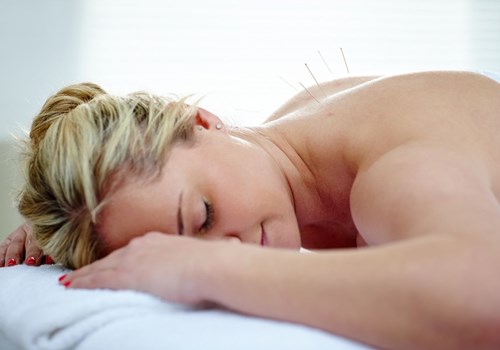 A woman laying face down on a towel while undergoing dry needling