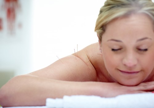 A woman laying face down on a towel while undergoing dry needling