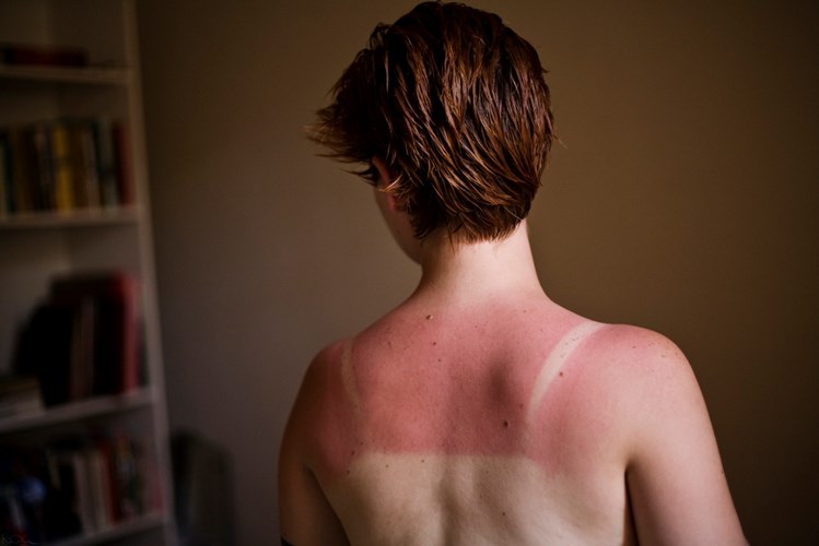 Skin-March.jpg