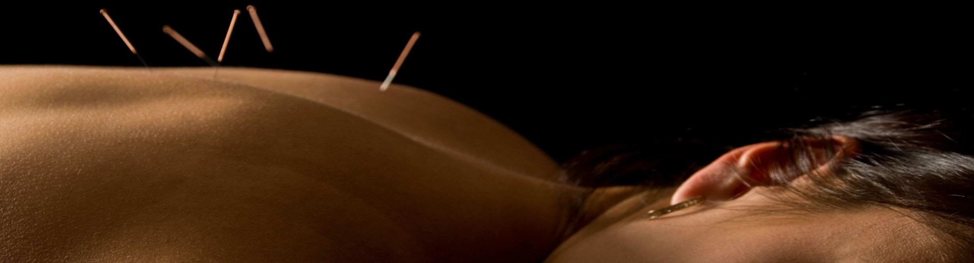 Acupuncture slim.jpg