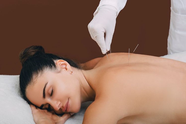 Acupuncture 20250226.JPG